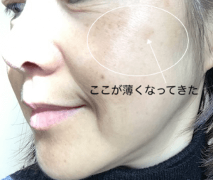 50代女性 MIMC化粧品 美白コンシーラ 敏感肌におすすめ