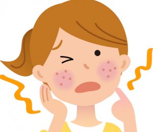 ５０代女性　ロイテリ菌　アトピー性皮膚炎の改善